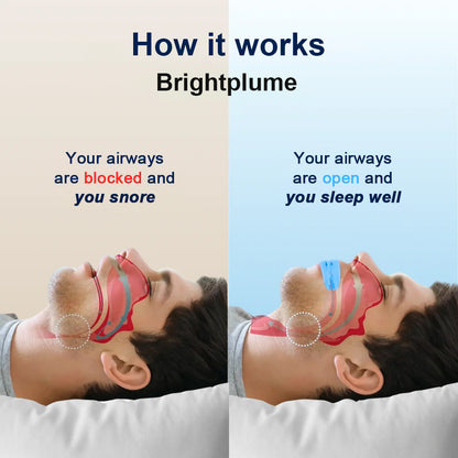 Brightplume™  Professional intelligent anti-snoring device